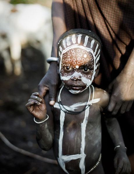 Boy with Blood © William J Palank