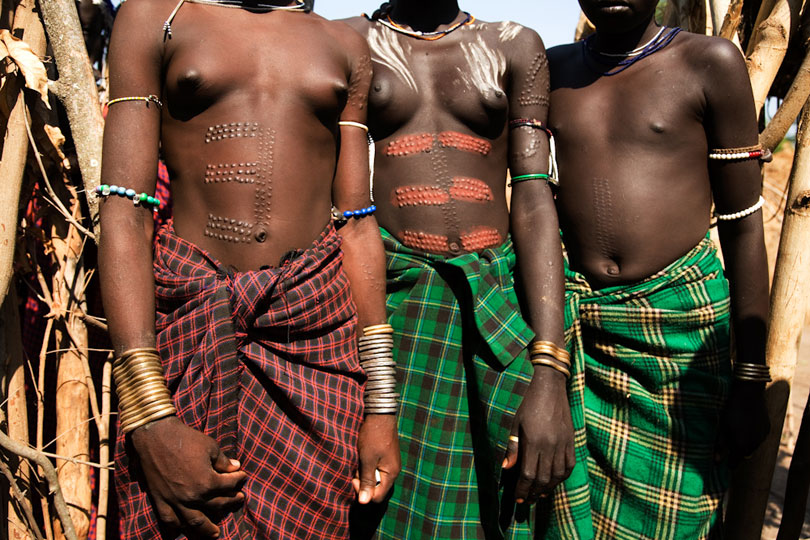 Beauty Scaring on eligible girls, Omo Valley, Ethiopia. © Andrew Geiger